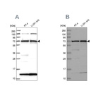 Western blot analysis using Anti-KLC2 antibody HPA040434 (A) shows similar pattern to independent antibody HPA040416 (B).