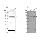 Western blot analysis using Anti-KLC2 antibody HPA040434 (A) shows similar pattern to independent antibody HPA040416 (B).