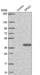 Western blot analysis in control (vector only transfected HEK293T lysate) and SPG21 over-expression lysate (Co-expressed with a C-terminal myc-DDK tag (~3.1 kDa) in mammalian HEK293T cells, LY413881).