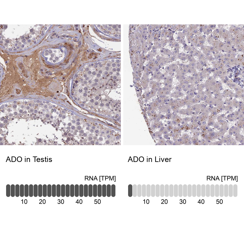 Anti-ADO Antibody