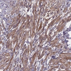 Immunohistochemical staining of human smooth muscle shows moderate positivity.