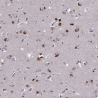 Immunohistochemical staining of human cerebral cortex shows strong positivity in neurons.