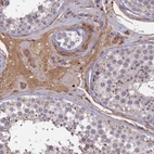 Immunohistochemical staining of human testis shows moderate cytoplasmic positivity in Leydig cells.