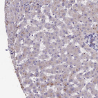 Immunohistochemical staining of human liver shows low positivity in hepatocytes as expected.