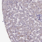 Immunohistochemical staining of human liver shows low positivity in hepatocytes as expected.