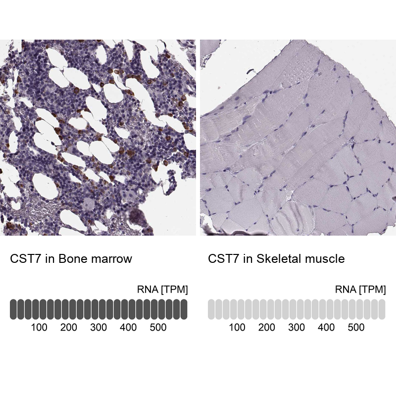 Anti-CST7 Antibody