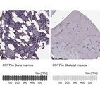 Anti-CST7 Antibody