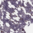 Immunohistochemical staining of human bone marrow shows strong cytoplasmic positivity in a subset of hematopoietic cells.