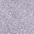Immunohistochemical staining of human liver shows no positivity in hepatocytes as expected.