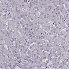 Immunohistochemical staining of human liver shows no positivity in hepatocytes as expected.
