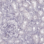 Immunohistochemical staining of human kidney shows no positivity in cells in tubules as expected.