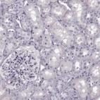 Immunohistochemical staining of human kidney shows no positivity in cells in tubules as expected.