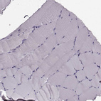 Immunohistochemical staining of human skeletal muscle shows no positivity in myocytes as expected.
