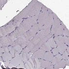 Immunohistochemical staining of human skeletal muscle shows no positivity in myocytes as expected.
