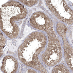 Immunohistochemical staining of human Testis shows strong cytoplasmic positivity in cells in seminiferous ducts.
