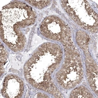 Immunohistochemical staining of human Testis shows strong cytoplasmic positivity in cells in seminiferous ducts.
