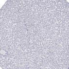Immunohistochemical staining of human Liver shows very weak cytoplasmic positivity in hepatocytes.