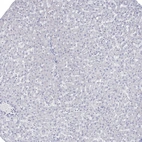 Immunohistochemical staining of human Liver shows very weak cytoplasmic positivity in hepatocytes.