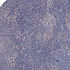 Immunohistochemical staining of human Lymph node shows very weak cytoplasmic positivity in non-germinal center cells.