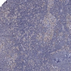 Immunohistochemical staining of human Lymph node shows very weak cytoplasmic positivity in non-germinal center cells.