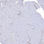 Immunohistochemical staining of human Skeletal muscle shows very weak cytoplasmic positivity in myocytes.