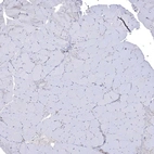 Immunohistochemical staining of human Skeletal muscle shows very weak cytoplasmic positivity in myocytes.