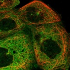 Immunofluorescent staining of human cell line A-431 shows localization to cytosol & microtubule organizing center.