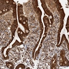 Anti-REP15 Antibody