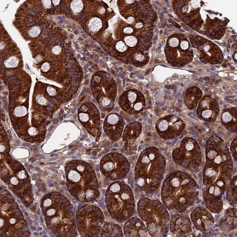 Anti-CCDC15 Antibody