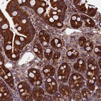 Anti-CCDC15 Antibody