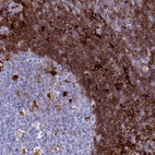 Anti-PLAC8 Antibody