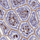 Immunohistochemical staining of human gastrointestinal tract shows moderate to strong cytoplasmic positivity in cells in lamina propria.