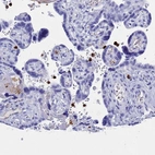 Immunohistochemical staining of human placenta shows moderate to strong cytoplasmic positivity in peripheral blood leukocytes.