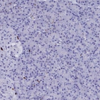 Immunohistochemical staining of human pancreas shows no positivity in exocrine glandular cells as expected.