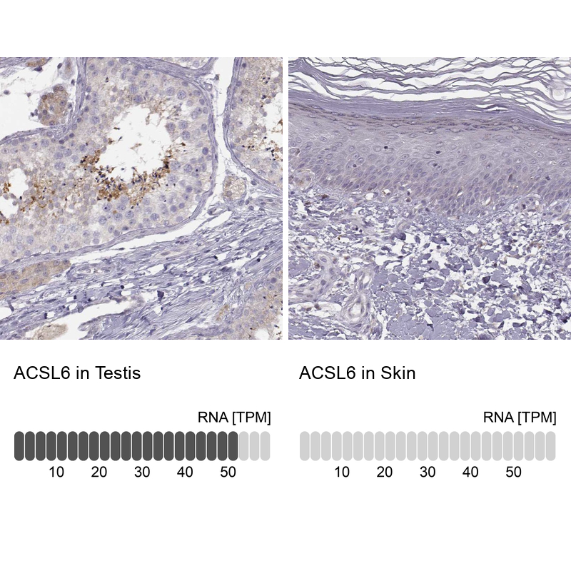 Anti-ACSL6 Antibody
