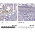 Anti-ACSL6 Antibody