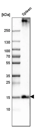 Western blot analysis in human spleen tissue.