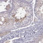Immunohistochemical staining of human testis shows high expression.