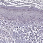 Immunohistochemical staining of human skin shows low expression as expected.