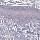 Immunohistochemical staining of human skin shows low expression as expected.