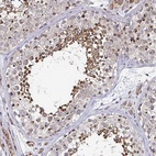 Immunohistochemical staining of human testis shows high expression.