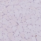 Immunohistochemical staining of human skeletal muscle shows low expression as expected.