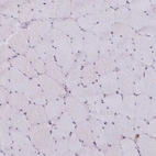 Immunohistochemical staining of human skeletal muscle shows low expression as expected.