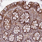 Anti-TMEM98 Antibody