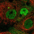 Anti-TMEM98 Antibody