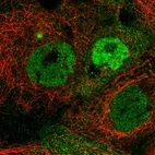 Immunofluorescent staining of human cell line A-431 shows localization to nucleoplasm & cytosol.