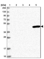 Lane 1: Marker [kDa] 250, 130, 95, 72, 55, 36, 28, 17, 10_br/_Lane 2: Human cell line RT-4_br/_Lane 3: Human cell line U-251MG sp_br/_Lane 4: Human plasma (IgG/HSA depleted)_br/_Lane 5: Human liver tissue