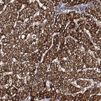 Anti-GLCE Antibody