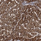 Anti-GLCE Antibody