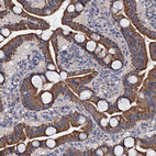 Immunohistochemical staining of human duodenum shows strong cytoplasmic positivity in glandular cells.